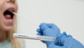 مستشار رئيس الجمهورية لشئون الصحة بمصر يكشف عن احتمالية توطن كورونا كمرض تنفسى متكرر فى الشتاء أمر قائم