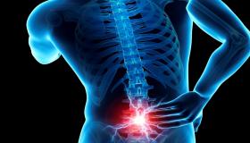 فتق الأقراص القطنية