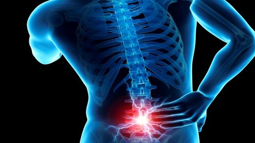 فتق الأقراص القطنية