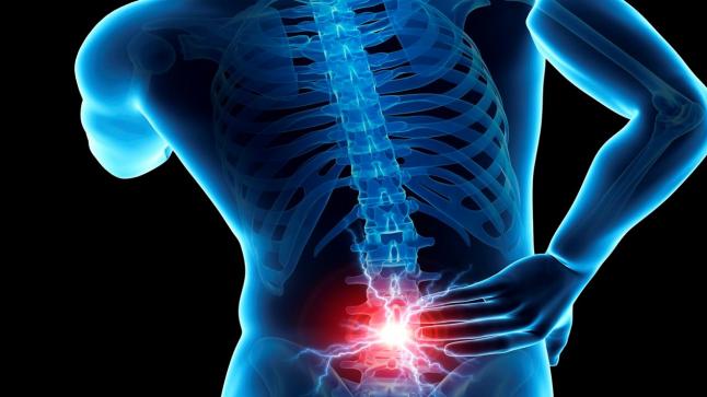 فتق الأقراص القطنية